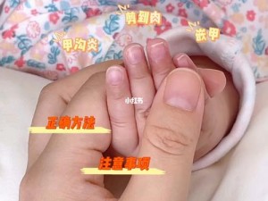 宝宝指甲护理的注意事项：选用婴儿专用指甲剪，注意修剪技巧，避免剪伤宝宝手指